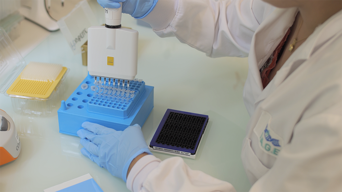 Préparation d'échantillons sur une microplaque en laboratoire