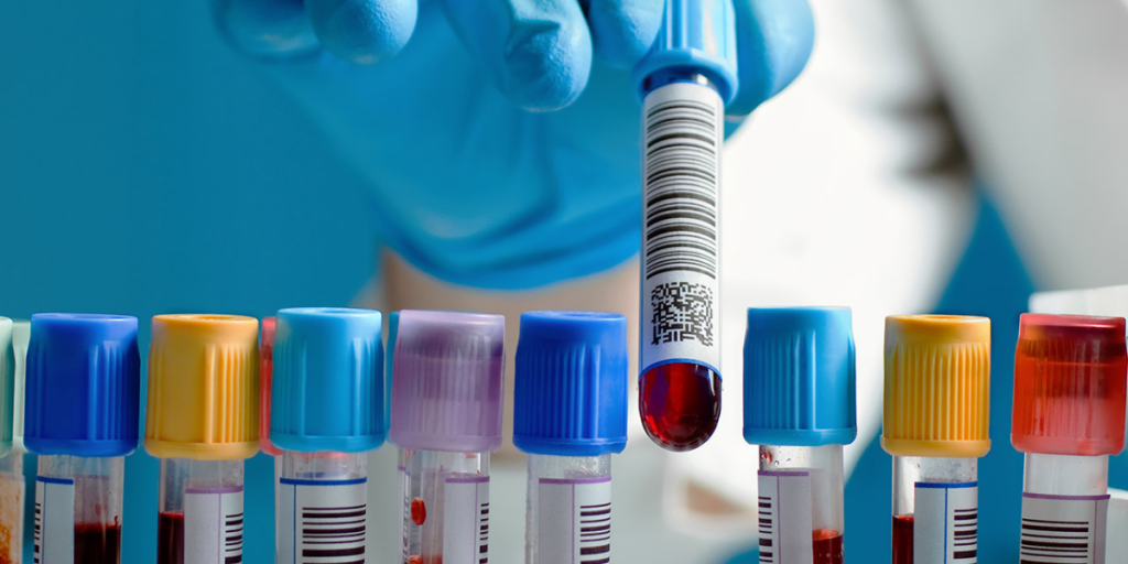 Traçabilité des produits et échantillons en laboratoire