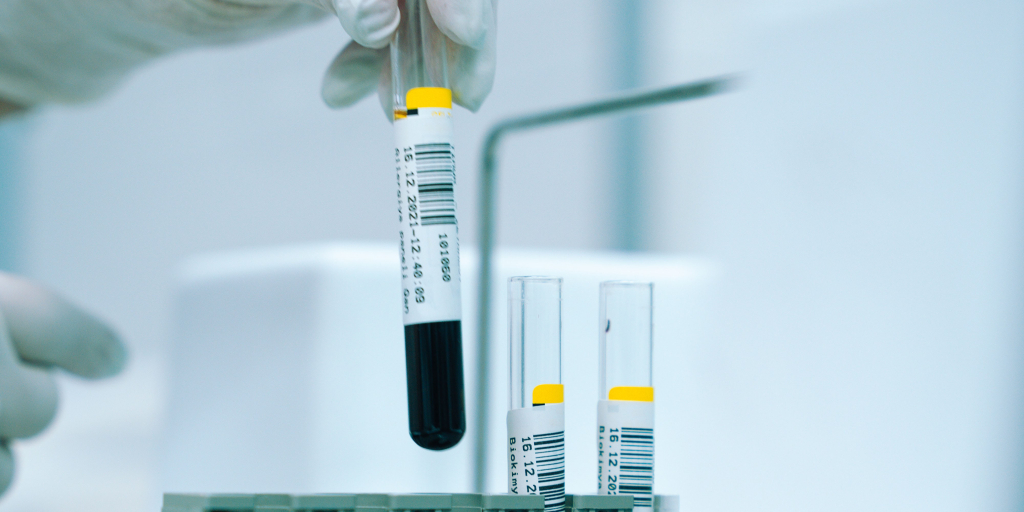 numéro de lot en laboratoire